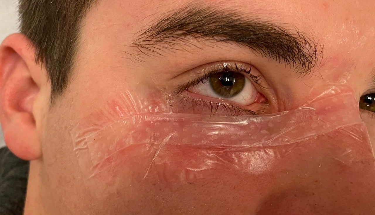Tijdens Scarmask